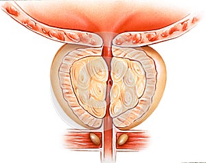 Prostate Gland - Benign Prostatic Hyperplasia BPH