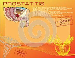Prostatitis