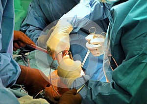 Prosthesis of the knee hospital operation