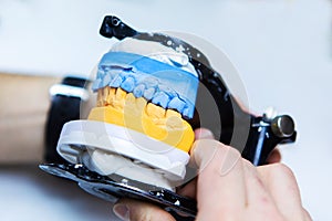 Prosthetic teeth. Mock jaw with teeth. Manufacturing of dental implants