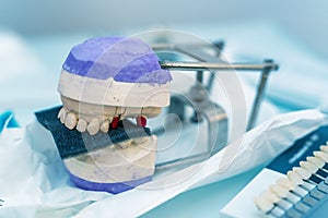 Prosthetic teeth organized on a white and purple support base is