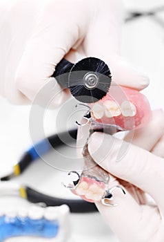 Prosthetics.partial dentures on a metal arc