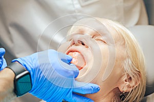 Prosthetics of the removable jaw of an elderly woman