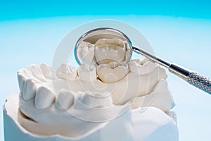 Prosthodontics or Prosthetic