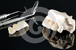 Prosthodontics or Prosthetic