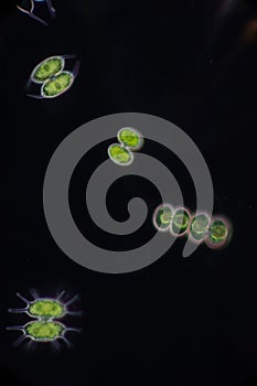 Protozoa and Green Algae in waste water under the microscope.