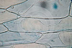 Protozoa and plant cells under the microscope for education.