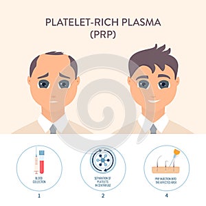 PRP hair loss treatment procedure medical poster