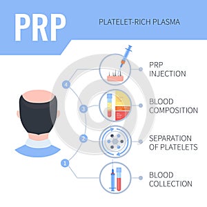 PRP hair regrowth therapy infographics for men