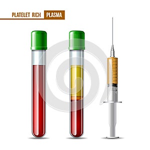 Test tubes and syringe with blood and plasma photo