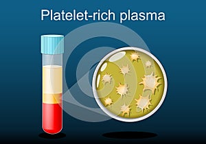 PRP. test tube with blood and platelet-rich plasma photo