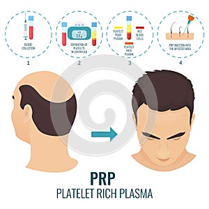 PRP treatment poster