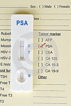 PSA negative