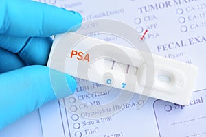 PSA positive test result