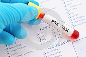 PSA test