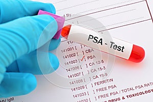 PSA test