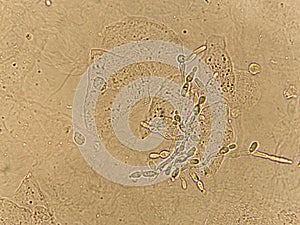 Pseudohyphae and budding yeast cells