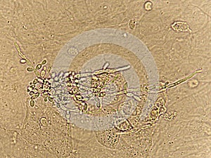 Pseudohyphae and budding yeast cells