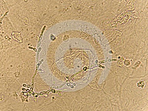 Pseudohyphae and budding yeast cells