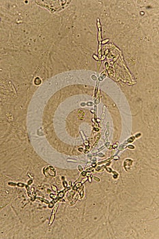 Pseudohyphae and budding yeast cells photo