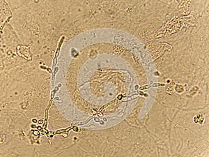 Pseudohyphae and budding yeast cells photo