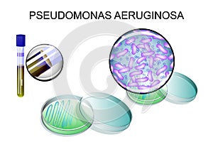 Pseudomonas aeruginosa. bacterial inoculation