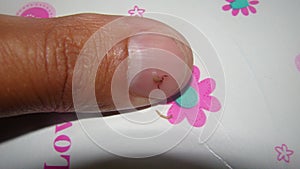Pseudoscorpion. comparison the size of a false scorpion on the fingernail photo