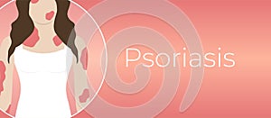 Psoriasis Illness Background Illustration with Woman with Red Skin