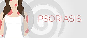 Psoriasis Skin Illness Background Illustration Design