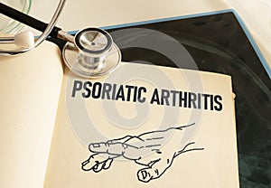 Psoriatic Arthritis is shown using the text photo