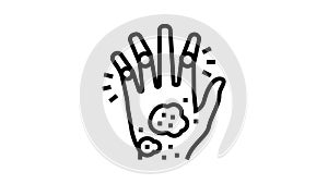 psoriatic arthritis skin health problem line icon animation