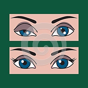 Ptosis, asymmetry of eyes