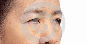 The ptosis or droopy eyelids in asian senior woman photo