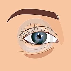 Puffy eye bag of aging woman\'s face, illustration