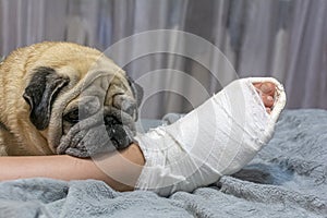 The pug laid his head on the ownerâ€™s foot. Human foot in a cast. The dog shows pity and compassion
