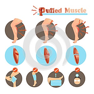 Pulled Muscle