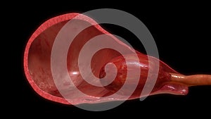 Pulling placenta out of uterus