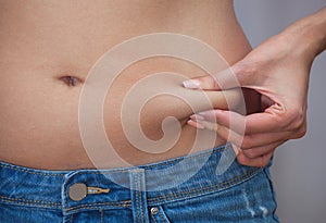 She pulls the hand skin showing fat in the abdomen and flanks.