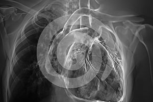 Pulmonologist examining with lungs 3D render X-ray radiography of chest organs photo