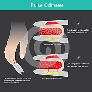 Pulse Oximeter. Illustration