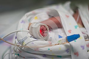 Pulse oximeter on preemie foot