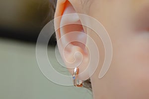The puncture of ears to children is younger than three years