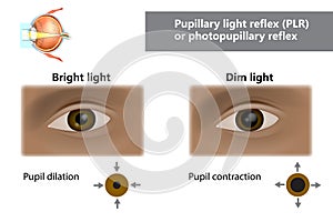 Pupillary light reflex PLR or photopupillary reflex. How do pupils change in size with dim and bright light