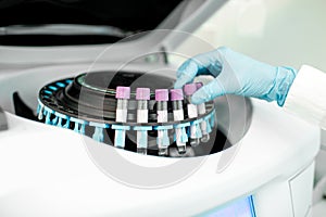 Putting test tubes into the holder of analyzer machine