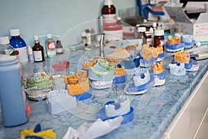 putty dental impressions, dentistry molds, at a dentistry practice