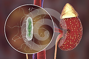 Pyelonephritis, medical concept, and close-up view of bacteria photo