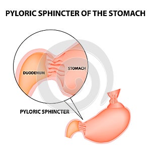 Pyloric sphincter of the stomach duodenum. Pylorus. Infographics. Vector image on isolated background photo