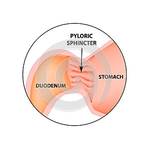 Pyloric sphincter of the stomach duodenum. Pylorus. Infographics. Vector image on isolated background photo