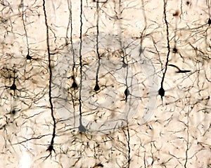 Pyramidal neurons