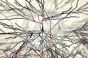 Pyramidal neurons, human brain cells